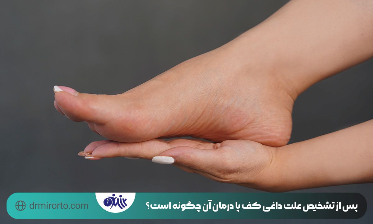 علت داغی کف پا 
