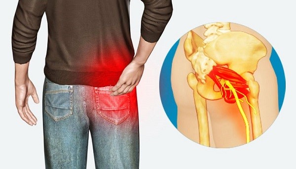 علت درد لگن سمت راست در مردان چیست؟ روش‌های درمانی