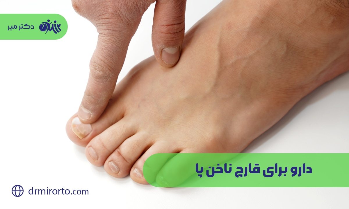 دارو برای قارچ ناخن پا