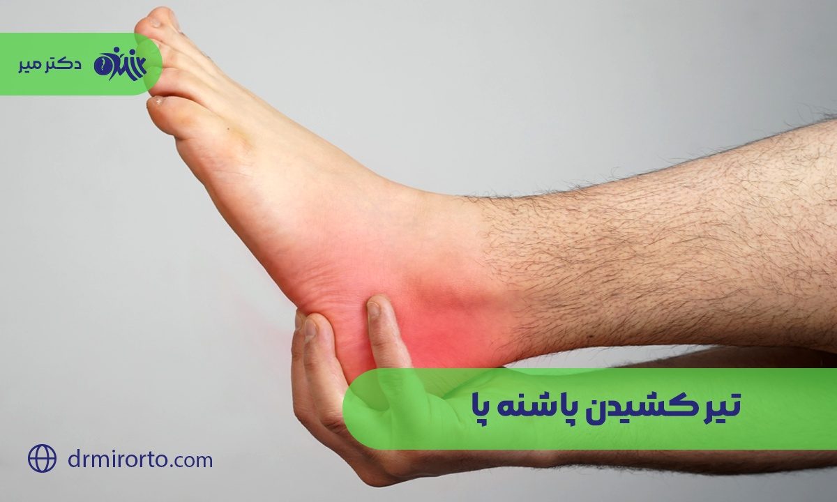تیر کشیدن پاشنه پا