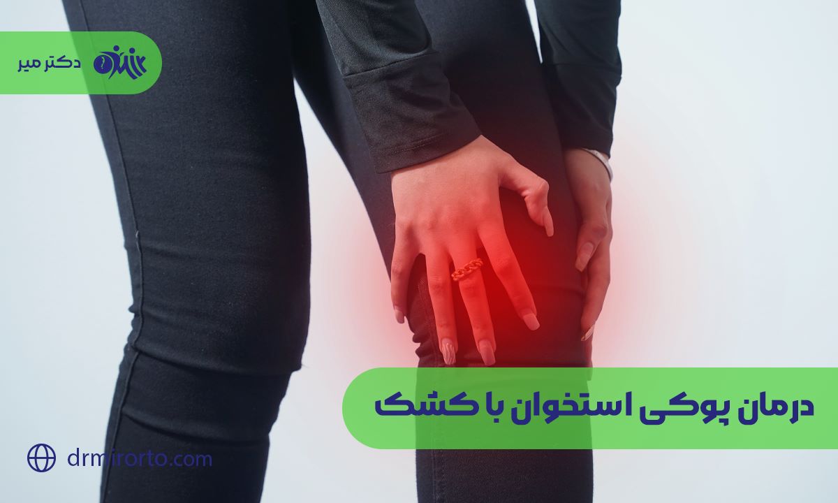 درمان پوکی استخوان با کشک